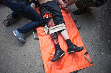 Kiev, Ukrayna April12, 2016: Yaralı adam yalan Kiev hastanede eğitim kurtarma görevi sırasında tıbbi bir halı üzerinde