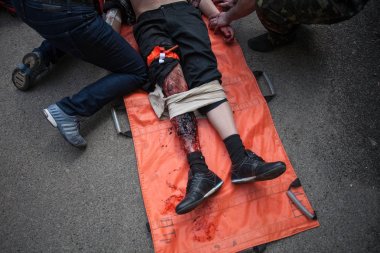 Kiev, Ukrayna April12, 2016: Askeri doktorlar eğitim kurtarma görevi Kiev hastanede katılmak
