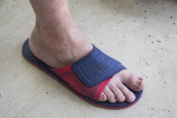 a man foot wearing slipper