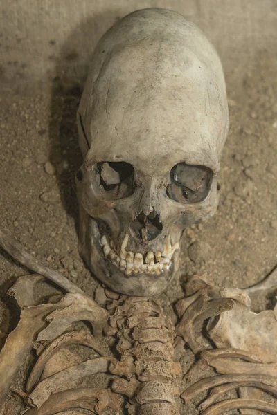 Kafatası ve yabancı gövde bölümü.