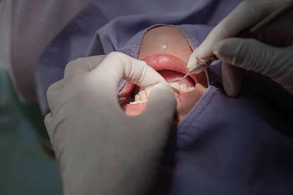 Tandheelkundige tanden patiënt door de tandarts. Tandheelkunde in het ziekenhuis — Stockfoto