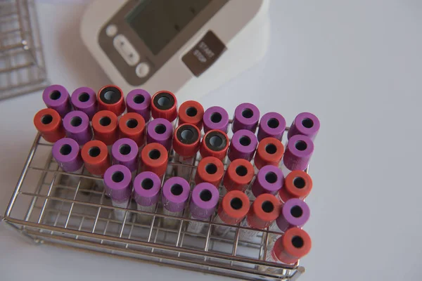 Muestra de tubo sanguíneo del paciente en el laboratorio  . —  Fotos de Stock