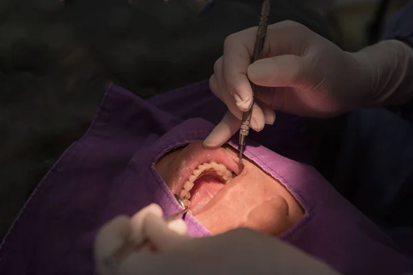 Paciente de dientes dentales por el dentista. Odontología en el hospital . — Foto de Stock