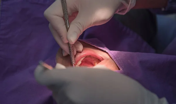 Paciente de dientes dentales por el dentista. Odontología en el hospital . — Foto de Stock