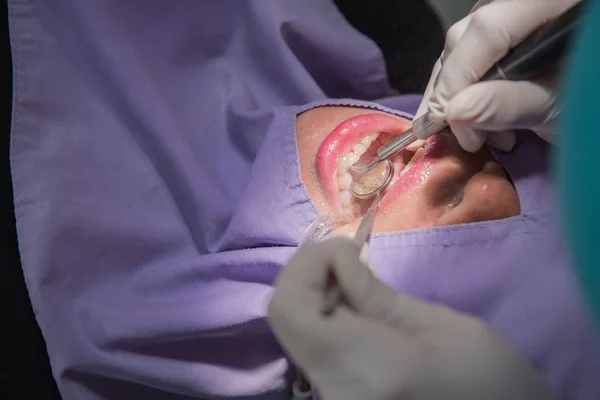 Limpeza dos dentes pelo dentista. Odontologia em hospital — Fotografia de Stock