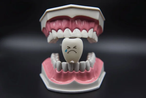 Model gigi mainan lucu di kedokteran gigi pada latar belakang hitam — Stok Foto