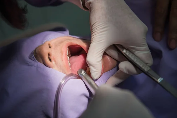 Zębów przez stomatologa do czyszczenia. Stomatologia w szpitalu — Zdjęcie stockowe