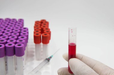 elinde kan tüpü örnek ve beyaz bir arka plan üzerinde şırınga. 