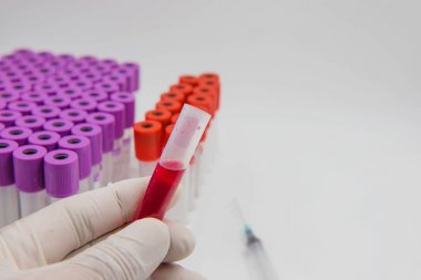 elinde kan tüpü örnek ve beyaz bir arka plan üzerinde şırınga. 