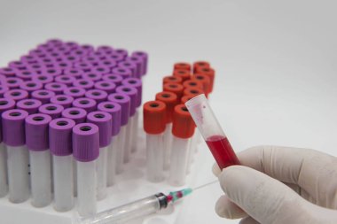 elinde kan tüpü örnek ve beyaz bir arka plan üzerinde şırınga. 