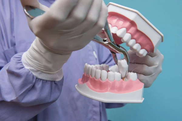 O modelo dentário é usado para Demonstração de extração dentária por médicos . — Fotografia de Stock