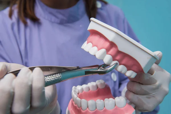 Stomatologiczne model jest używany do demonstracji Ekstrakcja zęba przez lekarzy. — Zdjęcie stockowe