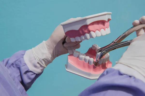 El modelo dental se utiliza para la demostración de la extracción dental por los médicos . — Foto de Stock