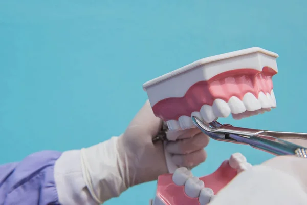 El modelo dental se utiliza para la demostración de la extracción dental por los médicos . — Foto de Stock