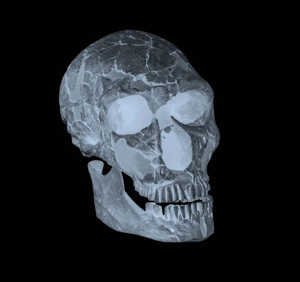 Yan yüz kafatası x-ray görüntü — Stok fotoğraf