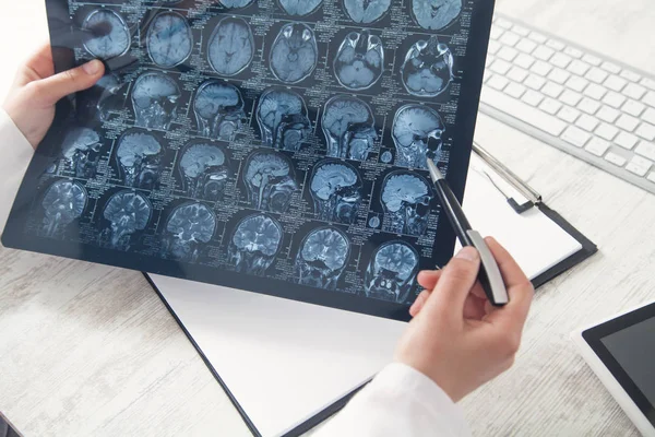 Läkare tittar på röntgenbild av huvudet. — Stockfoto