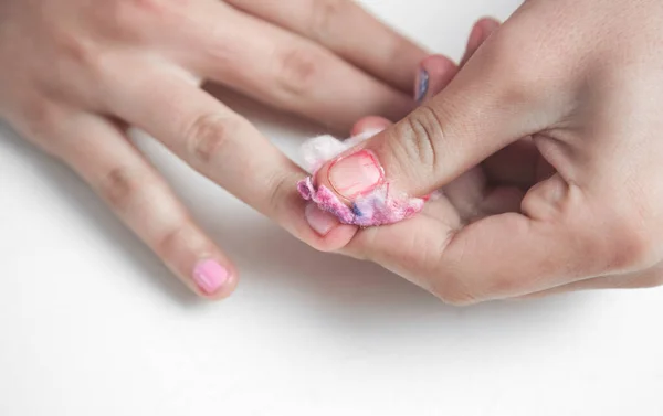 Hands Remove Manicure Fingernails — Stock Photo, Image
