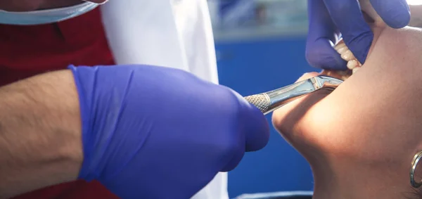 Dentist Remove Tooth Woman Patient Using Forceps — Stock Photo, Image