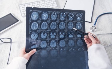 Doktor kafasının röntgenine bakıyor..