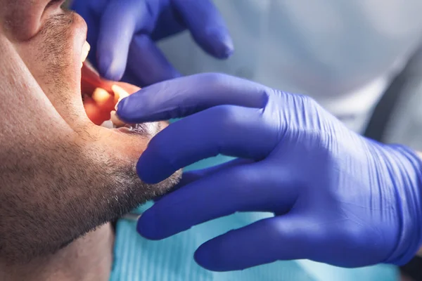 患者と歯科医の仕事 歯の調査 — ストック写真