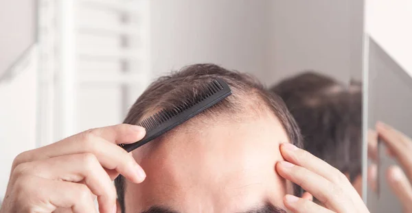 Caucasian man combing hair. Hair loss