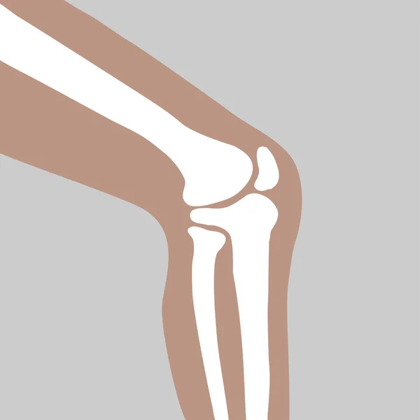Menselijke kniegewricht — Stockvector