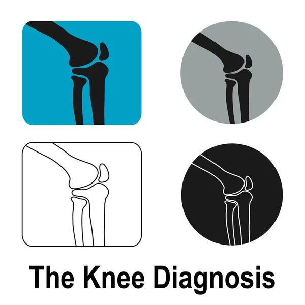 Людського колінного суглоба — стоковий вектор