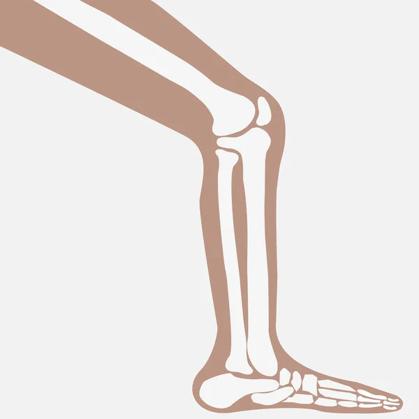 Vetor joelho humano — Vetor de Stock