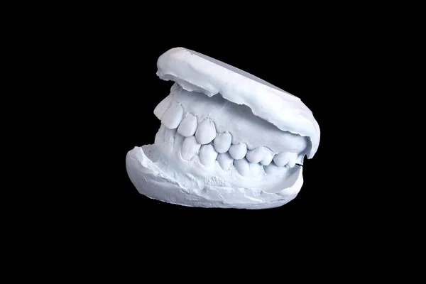 치과 검사, 석고 덴트 클리핑 경로와 검은 배경에 고립 모델 — 스톡 사진