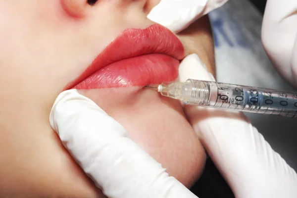 Plástico de conversión: Dermatólogo perder la inyección de filler en labios rojos — Foto de Stock