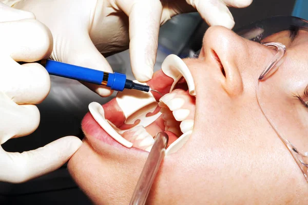 Dental surgeon performs teeth whitening treatment