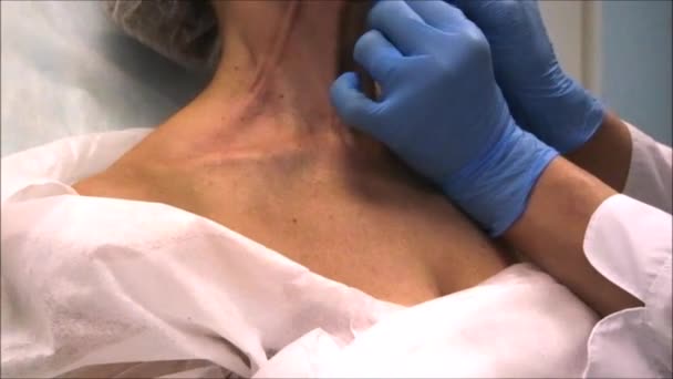 Le dermatologue marque des points sur la peau du cou avant le traitement de beauté pour rajeunir — Video