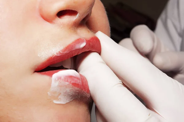 Contorno plástico: Masaje de labios después del contorno plástico — Foto de Stock