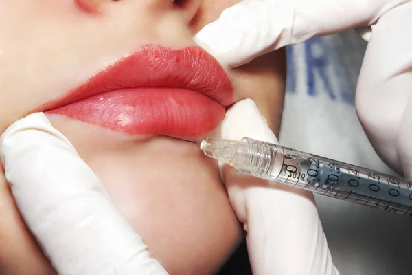 Doctor dermatologist performs contour plastic: Injection of filler