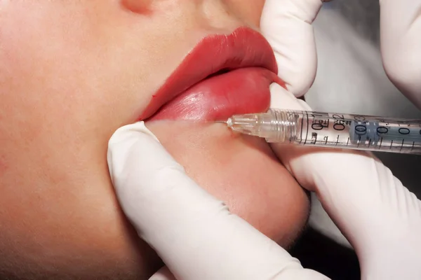 Doctor dermatologist performs Contour plastic: Injection of filler