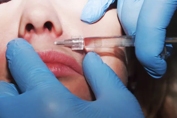 Dermatólogo realiza contorno plástico en los labios con relleno — Foto de Stock