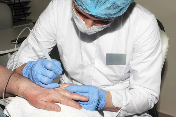 Mikrocerrahi: Cilt desesas kaldırma doktor dermatolog s