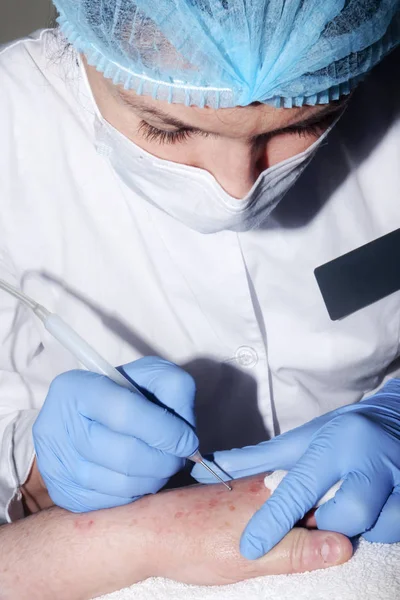 Mikrocerrahi: Cilt desesas kaldırma doktor dermatolog s