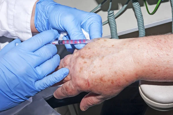 Mikrochirurgii: Dermatolog wykonuje wykonuje lokalnego anes — Zdjęcie stockowe