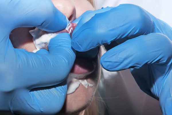 Obrysový plast: dermatolog provádí masáže rtů po c — Stock fotografie