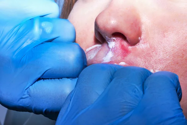 Contorno plástico: Dermatólogo realiza masaje de labios después de la c —  Fotos de Stock