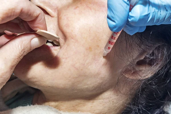 Dermatolog kozmetolojist botulinum toksin kozmetik enjeksiyon uyguluyor