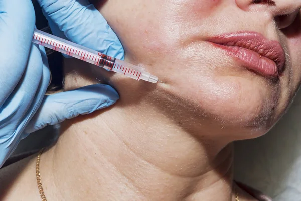 Dermatolog kozmetolojist botulinum toksin kozmetik enjeksiyon uyguluyor