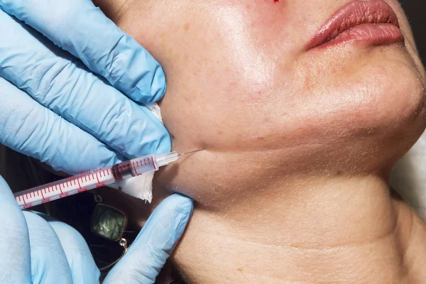 Dermatolog kosmetolog aplikuje kosmetické injekce botulotoxinu toxinu u pacienta středního věku na klinice krásy — Stock fotografie