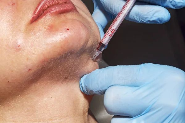 El cosmetólogo dermatólogo aplica la inyección cosmética de toxina botulínica en un paciente de mediana edad en un centro de belleza — Foto de Stock
