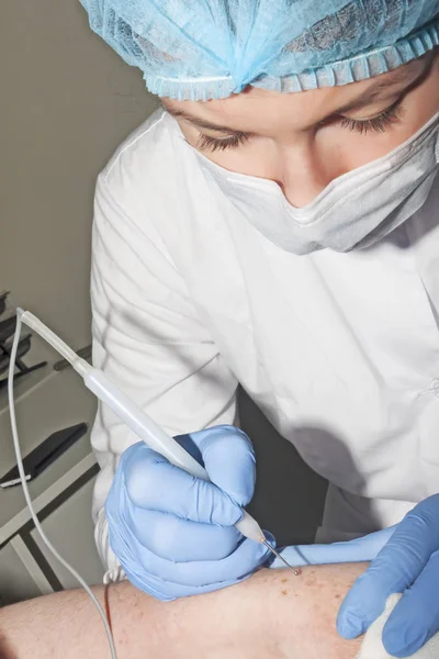 Dermatolog cerrah cilt hastalıkları ile electrocoagulator kaldırır