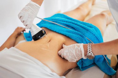 Cavitation RF vücut tedavisi ve sağlık güzelliğinin iyileştirilmesi ve yağ ve selülit alınması için çağdaş ilaç