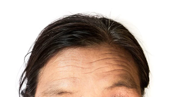Arrugas de primer plano en la frente anciana — Foto de Stock