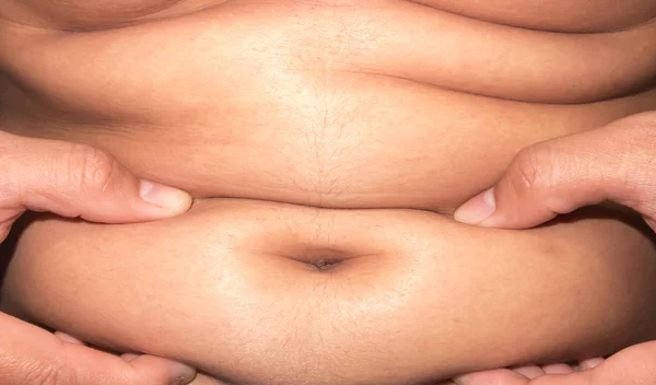 Close-up de gordura da mulher de superfície abdominal, cuidados saudáveis e conceito de beleza — Fotografia de Stock