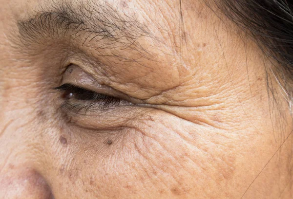 gros plan de lhomme de peau macro epidermis photo thinkstock plaie de chirurgie les d 233 mangeaisons et les irritations lorsque vous portez v 234 tements gros plan de lhomme de peau macro epidermis photo thinkstock plaie de chirurgie les d 233 mangeaisons et les irritations lorsque vous portez v 234 tements